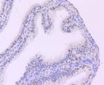 MYST2 Recombinant Rabbit Monoclonal Antibody (JM32-39)