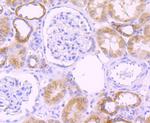 CYP2D6 Antibody in Immunohistochemistry (Paraffin) (IHC (P))