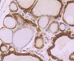 TUBA4A Antibody in Immunohistochemistry (Paraffin) (IHC (P))