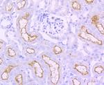 ACE Recombinant Rabbit Monoclonal Antibody (JM59-32)