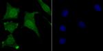 USP11 Recombinant Rabbit Monoclonal Antibody (JM33-62)