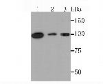 PKC mu Recombinant Rabbit Monoclonal Antibody (JM30-17)