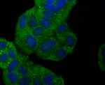 gamma Synuclein Recombinant Rabbit Monoclonal Antibody (JM90-32)
