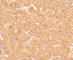 Ferritin Light Chain Antibody in Immunohistochemistry (Paraffin) (IHC (P))