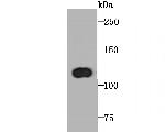 PPARGC1B Recombinant Rabbit Monoclonal Antibody (JM33-24)