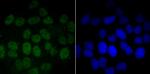 PFKFB3 Recombinant Rabbit Monoclonal Antibody (JM43-43)