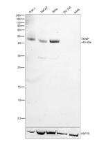 TXNIP Antibody in Western Blot (WB)