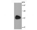 ANP Recombinant Rabbit Monoclonal Antibody (JM08-36)