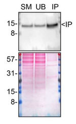 Galectin 1 Antibody in Immunoprecipitation (IP)