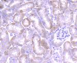 JAK1 Antibody in Immunohistochemistry (Paraffin) (IHC (P))