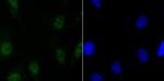 SATB2 Recombinant Rabbit Monoclonal Antibody (JM52-44)