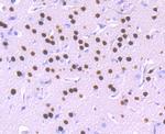 SATB2 Antibody in Immunohistochemistry (Paraffin) (IHC (P))