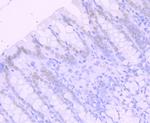 SATB2 Antibody in Immunohistochemistry (Paraffin) (IHC (P))