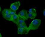 RAD51 Recombinant Rabbit Monoclonal Antibody (JM54-26)
