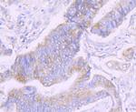 NDUFS3 Antibody in Immunohistochemistry (Paraffin) (IHC (P))