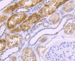 NDUFS3 Antibody in Immunohistochemistry (Paraffin) (IHC (P))
