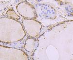 USP10 Antibody in Immunohistochemistry (Paraffin) (IHC (P))