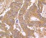 USP10 Antibody in Immunohistochemistry (Paraffin) (IHC (P))
