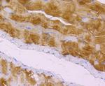 Zyxin Antibody in Immunohistochemistry (Paraffin) (IHC (P))