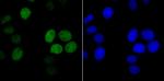 Histone H1.2 Antibody in Immunocytochemistry (ICC/IF)