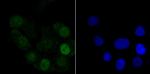 Histone H1.2 Recombinant Rabbit Monoclonal Antibody (JU43-48)