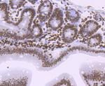 Histone H1.2 Antibody in Immunohistochemistry (Paraffin) (IHC (P))