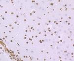 Histone H1.2 Antibody in Immunohistochemistry (Paraffin) (IHC (P))