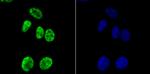 H3K14ac Recombinant Rabbit Monoclonal Antibody (JU43-26), ChIP-Verified