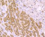SDHB Antibody in Immunohistochemistry (Paraffin) (IHC (P))