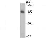 Drosha Antibody in Western Blot (WB)