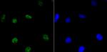 HDAC9 Recombinant Rabbit Monoclonal Antibody (JU30-44)
