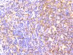 MAD2L2 Recombinant Rabbit Monoclonal Antibody (JU99-23)