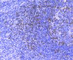 Zap-70 Antibody in Immunohistochemistry (Paraffin) (IHC (P))