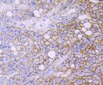 alpha-II Spectrin Recombinant Rabbit Monoclonal Antibody (JU32-09)