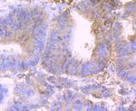 CD317 (BST2, PDCA-1) Recombinant Rabbit Monoclonal Antibody (JU11-93)