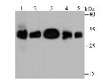 HLA-DQA1 Antibody in Western Blot (WB)