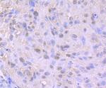 Nuclear Matrix Protein p84 Antibody in Immunohistochemistry (Paraffin) (IHC (P))