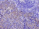 SQSTM1 Antibody in Immunohistochemistry (Paraffin) (IHC (P))