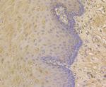 ORM1 Antibody in Immunohistochemistry (Paraffin) (IHC (P))