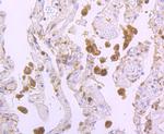 TIM-3 Antibody in Immunohistochemistry (Paraffin) (IHC (P))