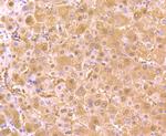 AKR1C1 Antibody in Immunohistochemistry (Paraffin) (IHC (P))