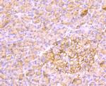 AKR1C1 Monoclonal Antibody (5-F10)