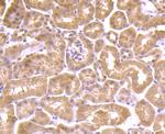 AKR1C1 Antibody in Immunohistochemistry (Paraffin) (IHC (P))