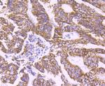 PCSK9 Antibody in Immunohistochemistry (Paraffin) (IHC (P))