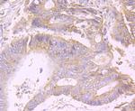PCSK9 Antibody in Immunohistochemistry (Paraffin) (IHC (P))
