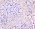 PCSK9 Antibody in Immunohistochemistry (Paraffin) (IHC (P))