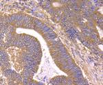 B-Raf Antibody in Immunohistochemistry (Paraffin) (IHC (P))