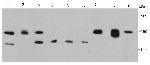 FGFR2 Monoclonal Antibody (A5-E10-G7)