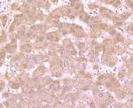 DOPA Decarboxylase Recombinant Rabbit Monoclonal Antibody (JA53-16)