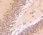 ZIC1 Antibody in Immunohistochemistry (Paraffin) (IHC (P))